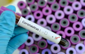 نتیجۀ آزمایش ۱۸ بیمار مشکوک به کرونا در جنوب کرمان منفی اعلام شد